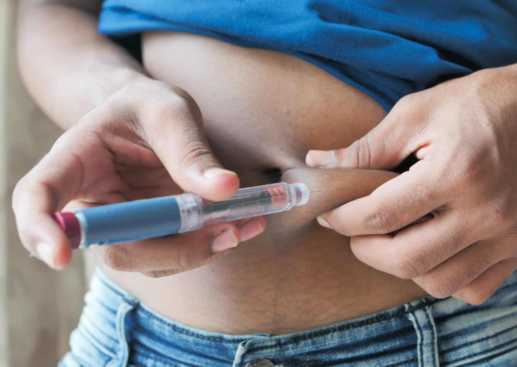 semaglutide before and after what to expect at every stage